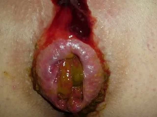 Quickly Shit In The Morning And The Beginning Of Menstruation screenshot 6