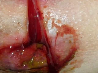 Quickly Shit In The Morning And The Beginning Of Menstruation screenshot 7