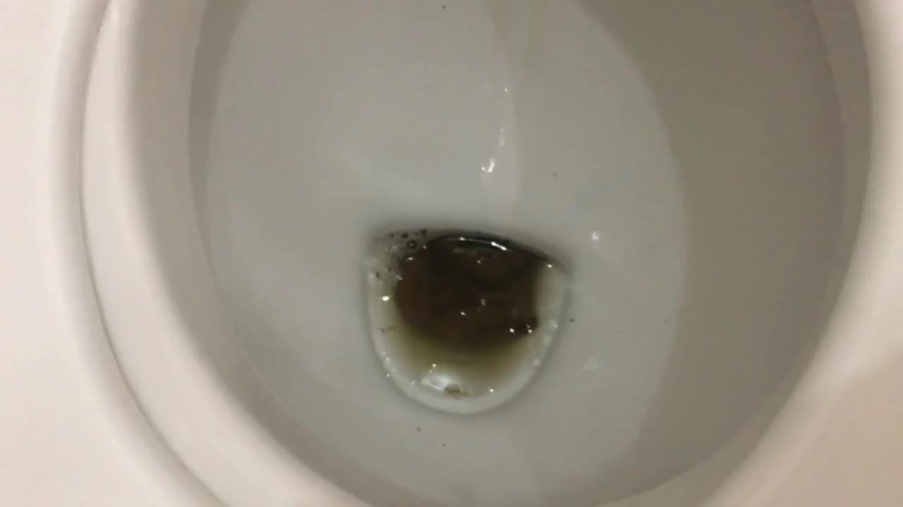 How Does A Lot Of Shit Fit In That Ass