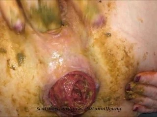 AutumnYoung – Shitty Prolapse screenshot 6