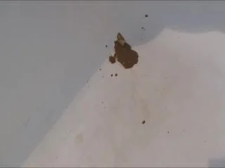 Diarrhea And Enema screenshot 3